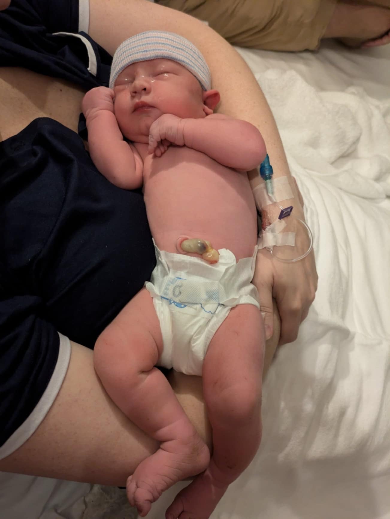 A photo of baby Hannah, lying in Carissa's arms, shortly after birth.